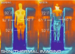 Captura de tela_11 - Câmaras de crioterapia e máquinas de emagrecimento VACUACTIVUS Câmara de crioterapia CryoStar baseada em nitrogênio líquido | imagem_6