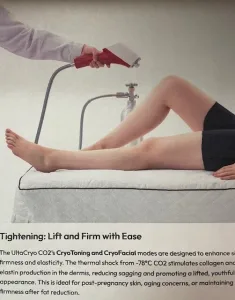 UltaCryo CO2 Sport and Spa Device image_2