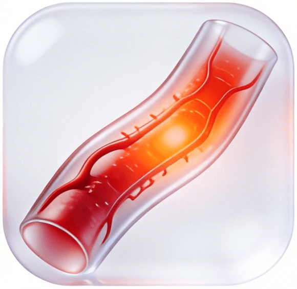 Querschnitt einer Arterie mit Plaqueablagerungen, die das Gefäß verengen, dargestellt in Rot und leuchtendem Orange.