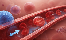 Querschnitt einer Arterie, der rote Blutkörperchen zeigt, und ein blauer Pfeil, der eine atherosklerotische Plaque hervorhebt.